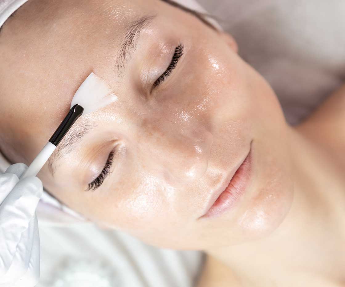 comparing Hydrafacial to chemical peels.